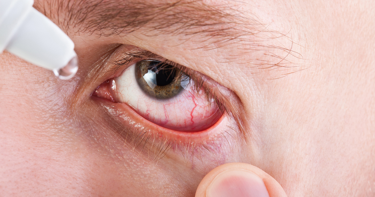 What you need to know for seasonal allergy relief